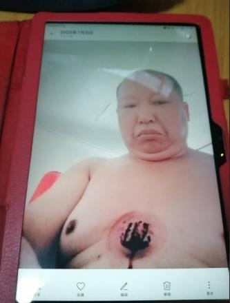 关于《五脏六腑》中医药技术修复