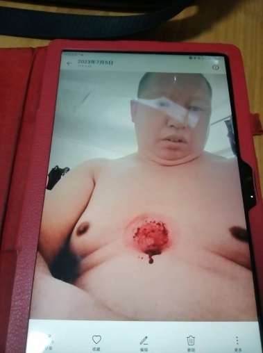 关于《五脏六腑》中医药技术修复